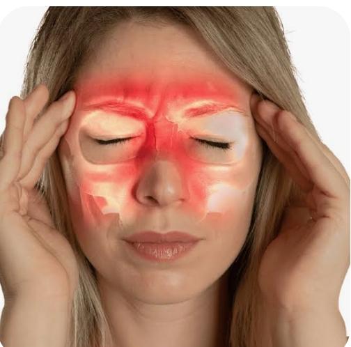 Headache Due to Sinusitis